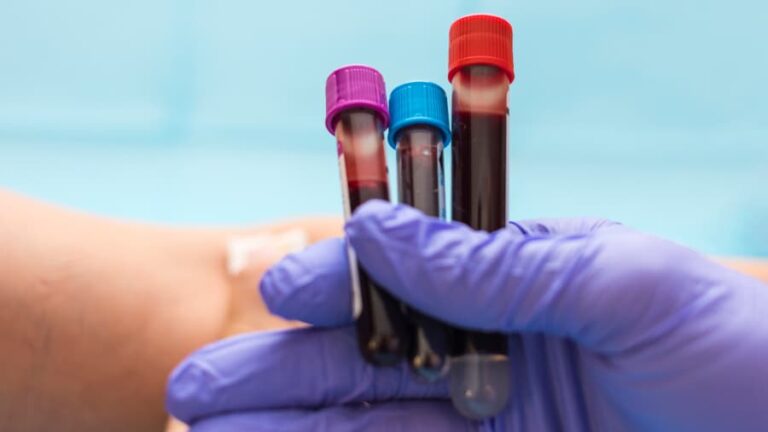 🧪 Εξετάσεις αίματος και ούρων: τι μετρά κάθε δείκτης και γιατί μας ενδιαφέρει